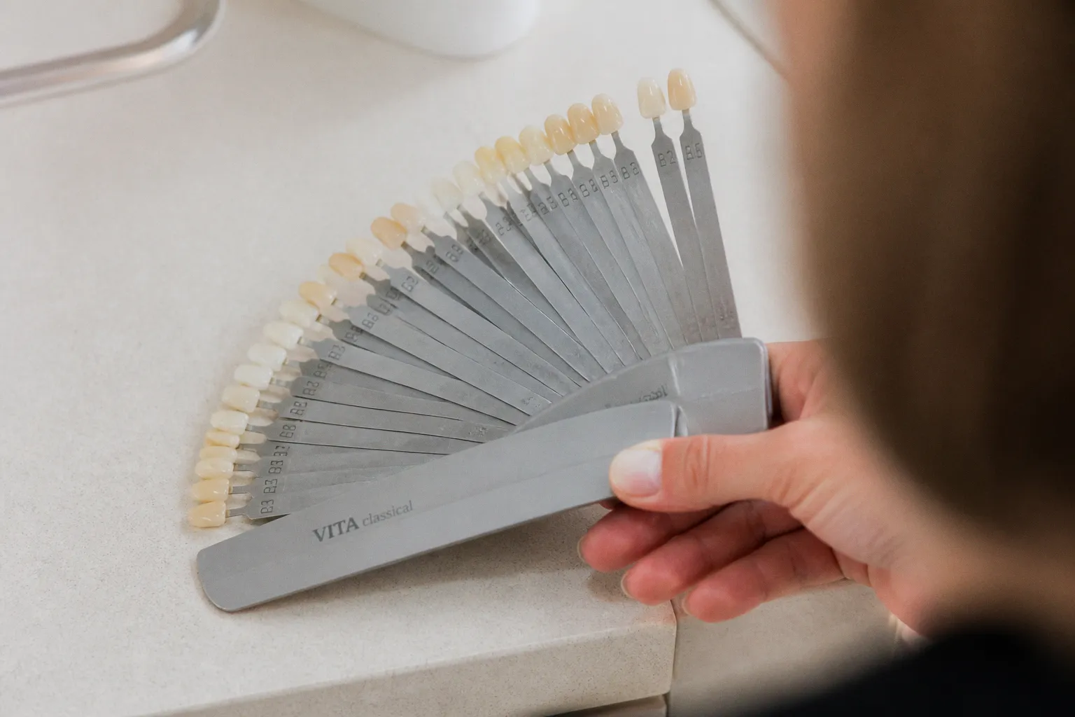 Smile Design: Der Weg zum Wunschlächeln in fünf Schritten