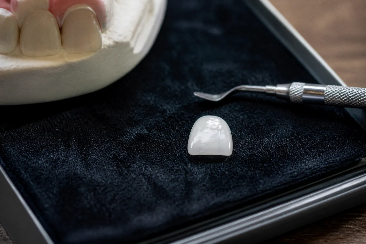 Veneers bei Zahnlücken: Was sich optisch wirklich verändert